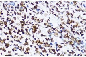 Immunohistochemistry of paraffin-embedded Human appendix using Acetyl-Histone H4-K12 Polyclonal Antibody at dilution of 1:200 (40x lens). (Histone H4 Antikörper  (acLys12))