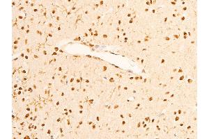 ABIN6267286 at 1/100 staining rat brain tissue sections by IHC-P. (TRKA Antikörper  (pTyr681, Tyr680))
