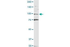 ZNF598 polyclonal antibody (A01). (ZNF598 Antikörper  (AA 28-126))