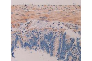 Used in DAB staining on fromalin fixed paraffin- embedded intestine tissue (MAP1A Antikörper  (AA 2110-2367))
