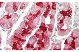 Detection of MUC6 in Human Stomach Tissue using Polyclonal Antibody to Mucin 6 (MUC6) (MUC6 Antikörper  (AA 2338-2439))