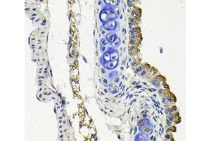 Immunohistochemistry of paraffin-embedded Mouse lung using MARK1 Polyclonal Antibody at dilution of 1:100 (40x lens). (MARK1 Antikörper)