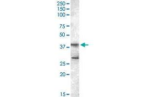 SKAP2 polyclonal antibody  staining (0. (SKAP2 Antikörper)