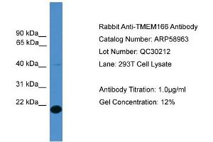 WB Suggested Anti-TMEM166  Antibody Titration: 0.