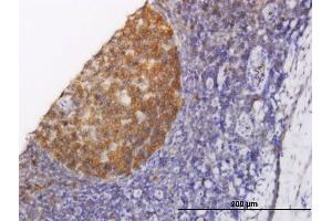 Immunoperoxidase of monoclonal antibody to NOLC1 on formalin-fixed paraffin-embedded human tonsil. (NOLC1 Antikörper  (AA 590-699))