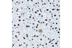 Immunohistochemistry (IHC) image for anti-ATR serine/threonine kinase (ATR) (pThr1989) antibody (ABIN7265777)