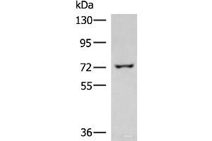 Western blot analysis of 293T cell lysate using GLS Polyclonal Antibody at dilution of 1:850 (Glutaminase Antikörper)