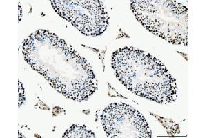 IHC analysis of MCM6 using anti-MCM6 antibody (ABIN7600037). (MCM6 Antikörper  (AA 14-821))