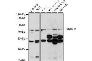 Western blot analysis of extracts of various cell lines, using KBTBD3 antibody (ABIN7268075) at 1:1000 dilution. (KBTBD3 Antikörper  (AA 520-612))