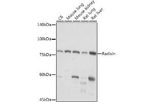 Western blot analysis of extracts of various cell lines, using Radixin Rabbit mAb (ABIN7269833) at 1:1000 dilution. (Radixin Antikörper)
