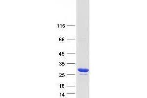 Western Blotting (WB) image for Tumor Protein D52-Like 2 (TPD52L2) (Transcript Variant 6) protein (Myc-DYKDDDDK Tag) (ABIN2734620)