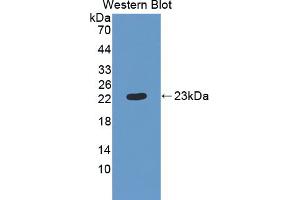 Western blot analysis of the recombinant protein. (CMTM8 Antikörper  (AA 1-173))