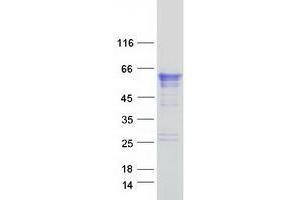 Western Blotting (WB) image for Transmembrane Protease, serine 4 (TMPRSS4) (Transcript Variant 1) protein (Myc-DYKDDDDK Tag) (ABIN2733924)