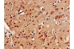 Immunohistochemistry of paraffin-embedded human brain tissue using ABIN7150279 at dilution of 1:100 (ERCC4 Antikörper  (AA 656-753))