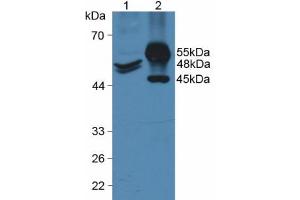 Western blot analysis of (1) Human HeLa cells and (2) Porcine Intestine Tissue. (KRT20 Antikörper  (AA 9-424))