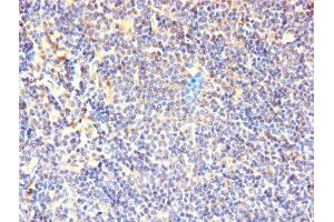 Immunohistochemistry of paraffin-embedded human lymphoid tissue using ABIN7171334 at dilution of 1:100 (CD7 Antikörper  (AA 26-180))