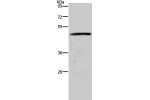 Western Blot analysis of 293T cell using HTR2B Polyclonal Antibody at dilution of 1:500 (Serotonin Receptor 2B Antikörper)
