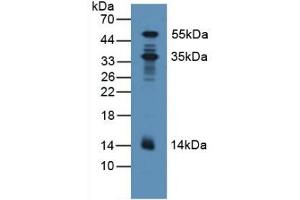Detection of PDXK in Human Lung Tissue using Polyclonal Antibody to Pyridoxal Kinase (PDXK) (PDXK Antikörper  (AA 29-253))