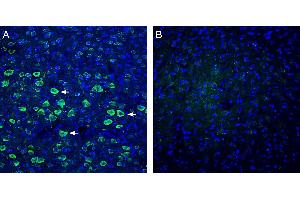 Expression of IGF1 in mouse parietal cortex. (Insulin-Like Growth Factor 1 (IGF1) Peptid)