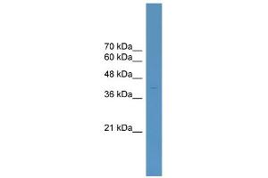WB Suggested Anti-ELK4 Antibody Titration:  0. (ELK4 Antikörper  (C-Term))