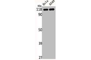 Western Blot analysis of HELA A549 cells using IARS2 Polyclonal Antibody (IARS2 Antikörper  (N-Term))
