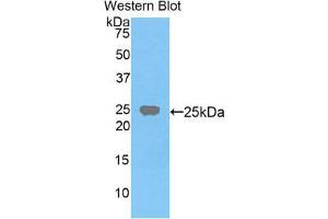Western Blotting (WB) image for anti-Farnesyl-Diphosphate Farnesyltransferase 1 (FDFT1) (AA 217-416) antibody (ABIN3206187) (FDFT1 Antikörper  (AA 217-416))