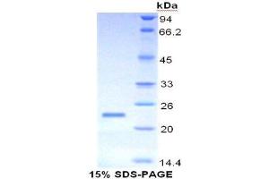 SDS-PAGE analysis of Human Mucin 4 Protein. (MUC4 Protein)