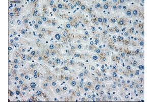 Immunohistochemical staining of paraffin-embedded liver tissue using anti-CHEK2mouse monoclonal antibody. (CHEK2 Antikörper)