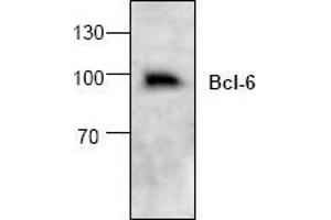 Image no. 1 for anti-B-Cell CLL/lymphoma 6 (BCL6) (C-Term) antibody (ABIN127089) (BCL6 Antikörper  (C-Term))