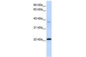 C11ORF74 Antikörper  (C-Term)