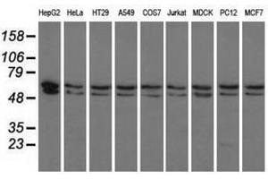 Image no. 3 for anti-Pantothenate Kinase 2 (PANK2) antibody (ABIN1500026) (PANK2 Antikörper)