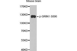 Western Blotting (WB) image for anti-Glutamate Receptor, Ionotropic, N-Methyl D-Aspartate 1 (GRIN1) (pSer896) antibody (ABIN1681627) (GRIN1/NMDAR1 Antikörper  (pSer896))
