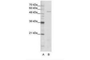 Image no. 1 for anti-Serine--tRNA Ligase, Cytoplasmic-Like (AA 241-290) antibody (ABIN202696) (Serine--tRNA Ligase, Cytoplasmic-Like (AA 241-290) Antikörper)