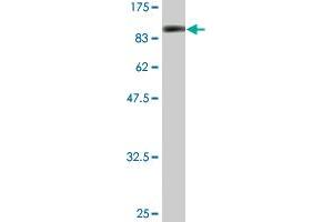 Western Blot detection against Immunogen (86. (SMAD4 Antikörper  (AA 1-552))