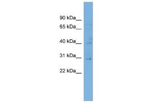 WB Suggested Anti-C1orf111 Antibody Titration:  0. (C1ORF111 Antikörper  (N-Term))