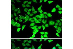 Immunofluorescence analysis of MCF-7 cells using HDAC7 Polyclonal Antibody (HDAC7 Antikörper)