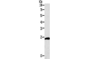 Gel: 12 % SDS-PAGE, Lysate: 40 μg, Lane: Hela cells, Primary antibody: ABIN7131115(SNAP25 Antibody) at dilution 1/400, Secondary antibody: Goat anti rabbit IgG at 1/8000 dilution, Exposure time: 10 seconds (SNAP25 Antikörper)