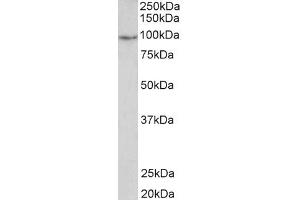 Western Blotting (WB) image for anti-phosphodiesterase 4B, cAMP-Specific (PDE4B) antibody (ABIN5930180) (PDE4B Antikörper)