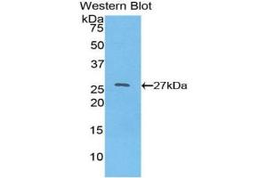 Detection of Recombinant HNF4a, Human using Polyclonal Antibody to Hepatocyte Nuclear Factor 4 Alpha (HNF4a) (HNF4A Antikörper  (AA 131-330))