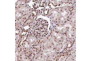 Immunohistochemical staining of human kidney with PDS5B polyclonal antibody  shows strong nuclear positivity in cells in tubules and cells in glomeruli. (PDS5B Antikörper)