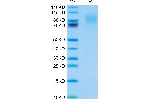 CEACAM1 Protein (AA 35-428) (His tag)
