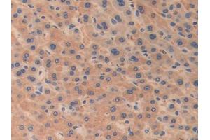 Figure. (ODC1 Antikörper  (AA 15-259))