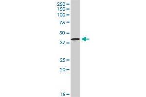 CA12 MaxPab rabbit polyclonal antibody. (CA12 Antikörper  (AA 1-354))