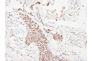 Immunohistochemistry (IHC) image for anti-E1A Binding Protein P300 (EP300) (AA 950-1000) antibody (ABIN7448706) (p300 Antikörper  (AA 950-1000))
