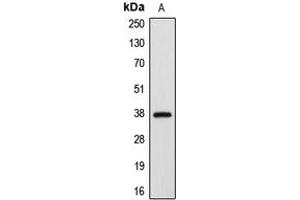 Western blot analysis of APAF-1 expression in HeLa (A) whole cell lysates. (APAF1 Antikörper  (C-Term))