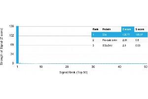 Analysis of Protein Array containing more than 19,000 full-length human proteins using Complement C3d Mouse Monoclonal Antibody (C3D/2891) Z- and S- Score: The Z-score represents the strength of a signal that a monoclonal antibody (Monoclonal Antibody) (in combination with a fluorescently-tagged anti-IgG secondary antibody) produces when binding to a particular protein on the HuProtTM array. (Complement 3d (C3d) (Acute Humoral Rejection Marker) Antikörper)