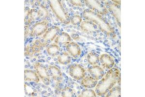 Immunohistochemistry of paraffin-embedded rat kidney using ASPSCR1 antibody (ABIN5975297) at dilution of 1/100 (40x lens). (ASPSCR1 Antikörper)
