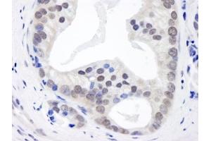 Immunohistochemistry (IHC) image for anti-Casein kappa (CSN3) (AA 325-375) antibody (ABIN7448493) (CSN3 Antikörper  (AA 325-375))