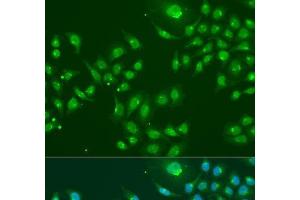 Immunofluorescence analysis of U2OS cells using IFIT3 Polyclonal Antibody at dilution of 1:100. (IFIT3 Antikörper)