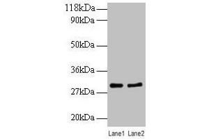 Western blot All lanes: RPL8 antibody at 2 μg/mL Lane 1: EC109 whole cell lysate Lane 2: 293T whole cell lysate Secondary Goat polyclonal to rabbit IgG at 1/10000 dilution Predicted band size: 29 kDa Observed band size: 29 kDa (RPL8 Antikörper  (AA 3-257))